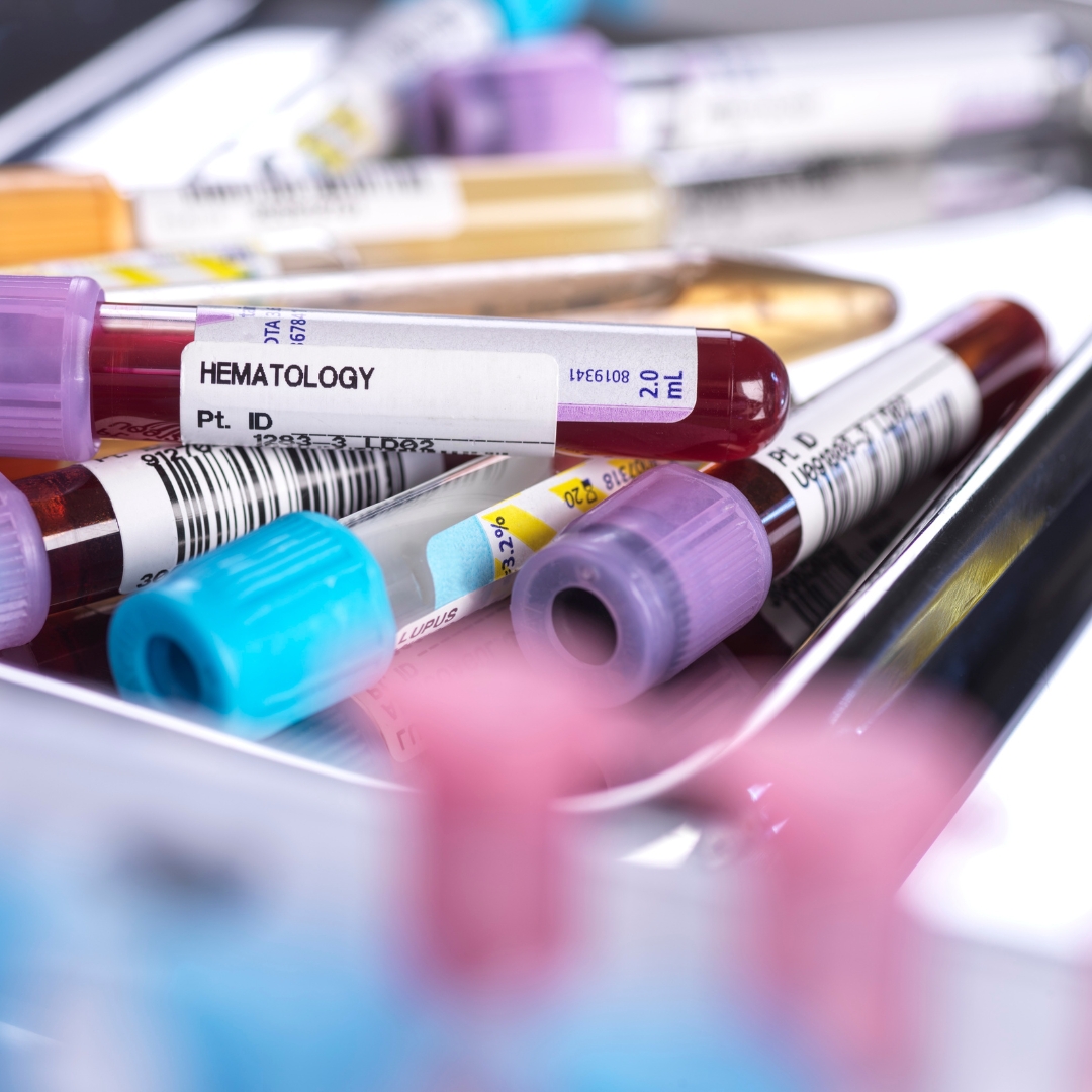 Blood Test Preparation